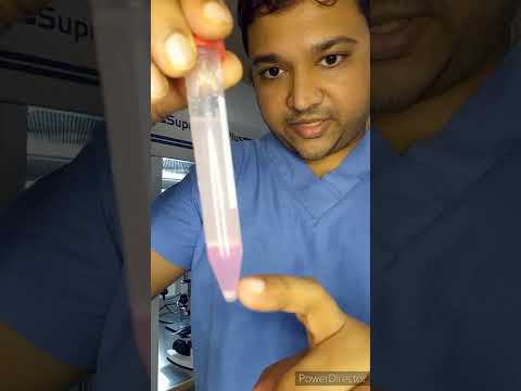 Watch the video
